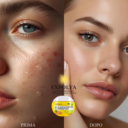 EXFOLYA Dischetti Esfolianti alla Curcuma e Acido Cogico